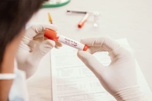 COVID-19 La importancia de los kits para la toma de muestras desde casa