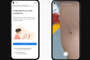 Google lanzó herramienta para analizar condiciones dermatológicas comunes desde la cámara de un celular