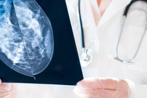 Inteligencia Artificial para la detección de cáncer de mama
